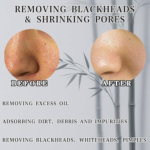Miniatura 5 de Máscara exfoliante de extracción, poder de limpieza profunda para desterrar puntos negros y puntos blancos, adecuado para todo tipo de piel, incluye