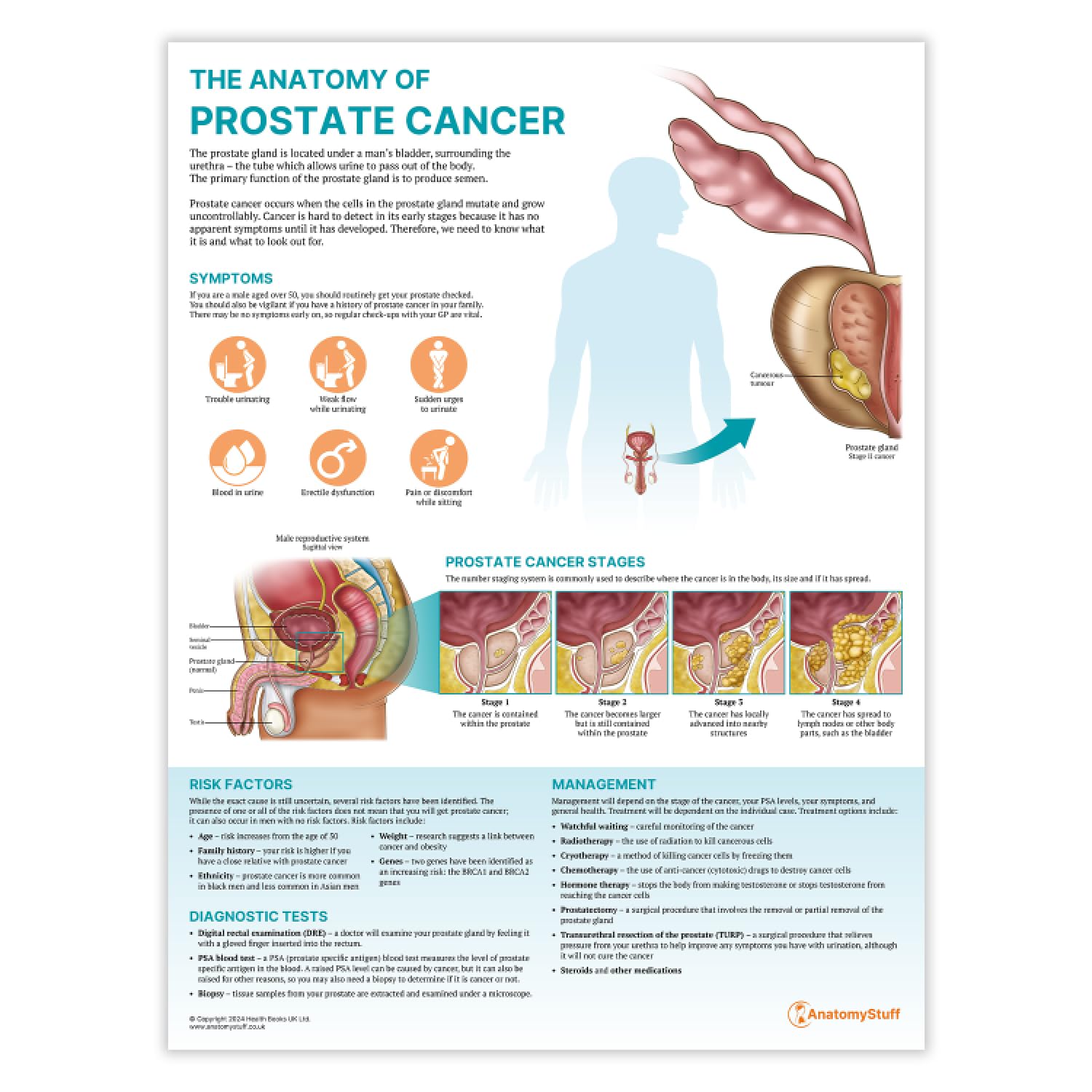Anatomy Stuff Men's Prostate Cancer The Anatomy Of Poster/Chart, 45X60 Cm, 18X24 Inches, Understanding Diagram, Anatomy And Physiology, Health