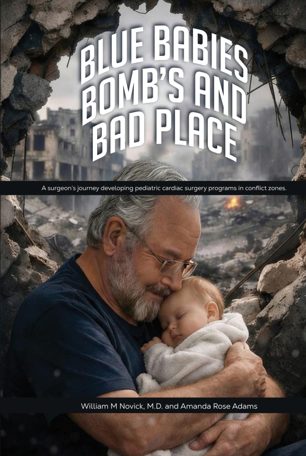 Blue Babies, Bomb’s and Bad Places: A surgeon’s journey developing pediatric cardiac surgery programs in conflict zones. Authors William M Novick, M.D. and Amanda Rose