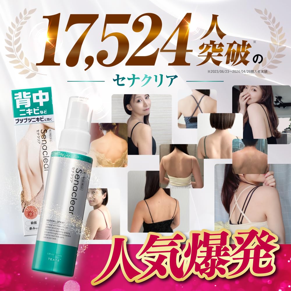 Amazon | 【第2類医薬品】セナクリア 100ml | セナクリア | ニキビ改善