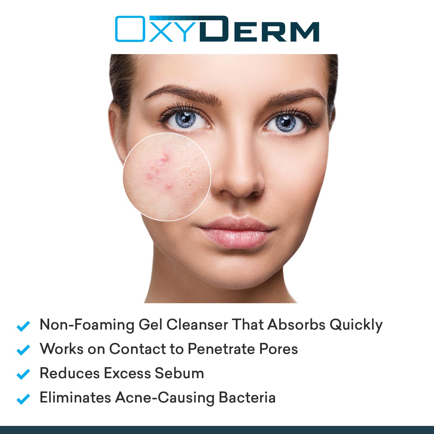 Acne Face wash Treatment with Benzoyl Peroxide 10% - Clears Cystic Breakouts & Fights Acne Blemishes on Contact. Prevents Future Pimples, Blackheads, Whiteheads, Zits, Bumps. For Face & Body.