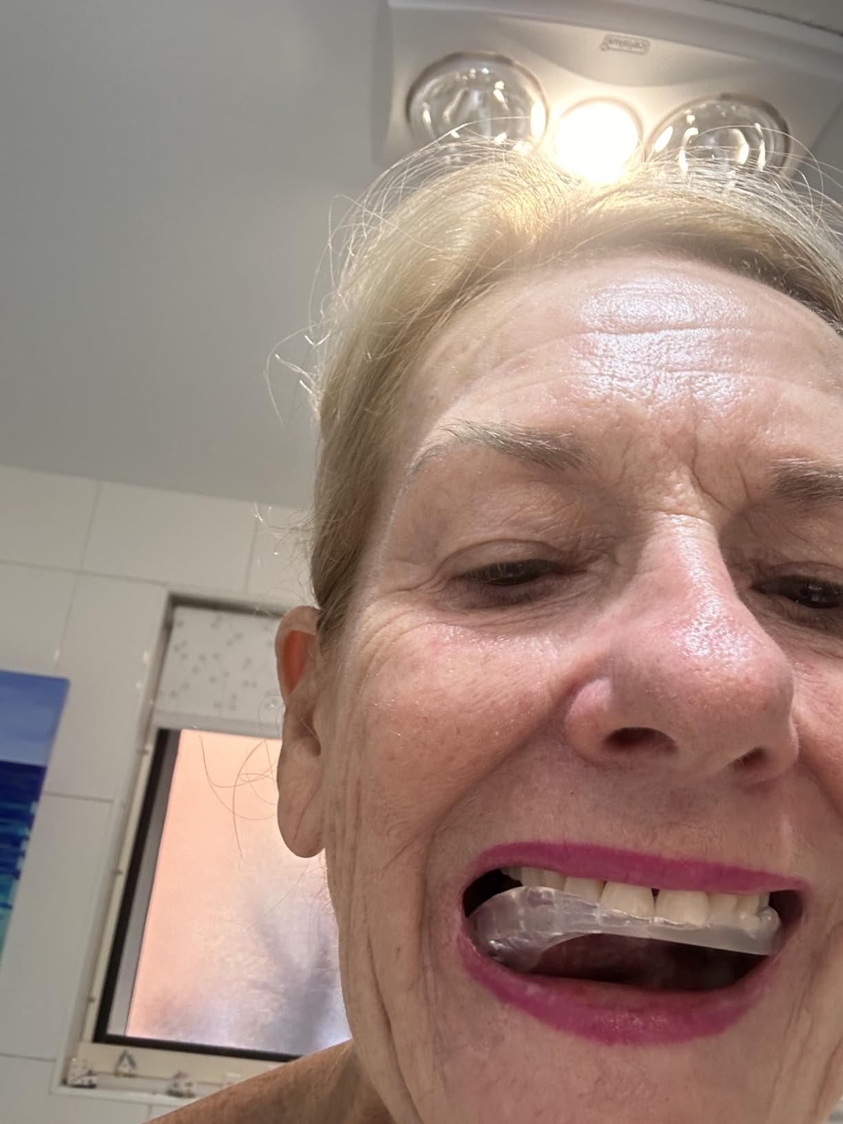 OralB Nighttime Dental Guard, Less Than 3Minutes for Custom Teeth