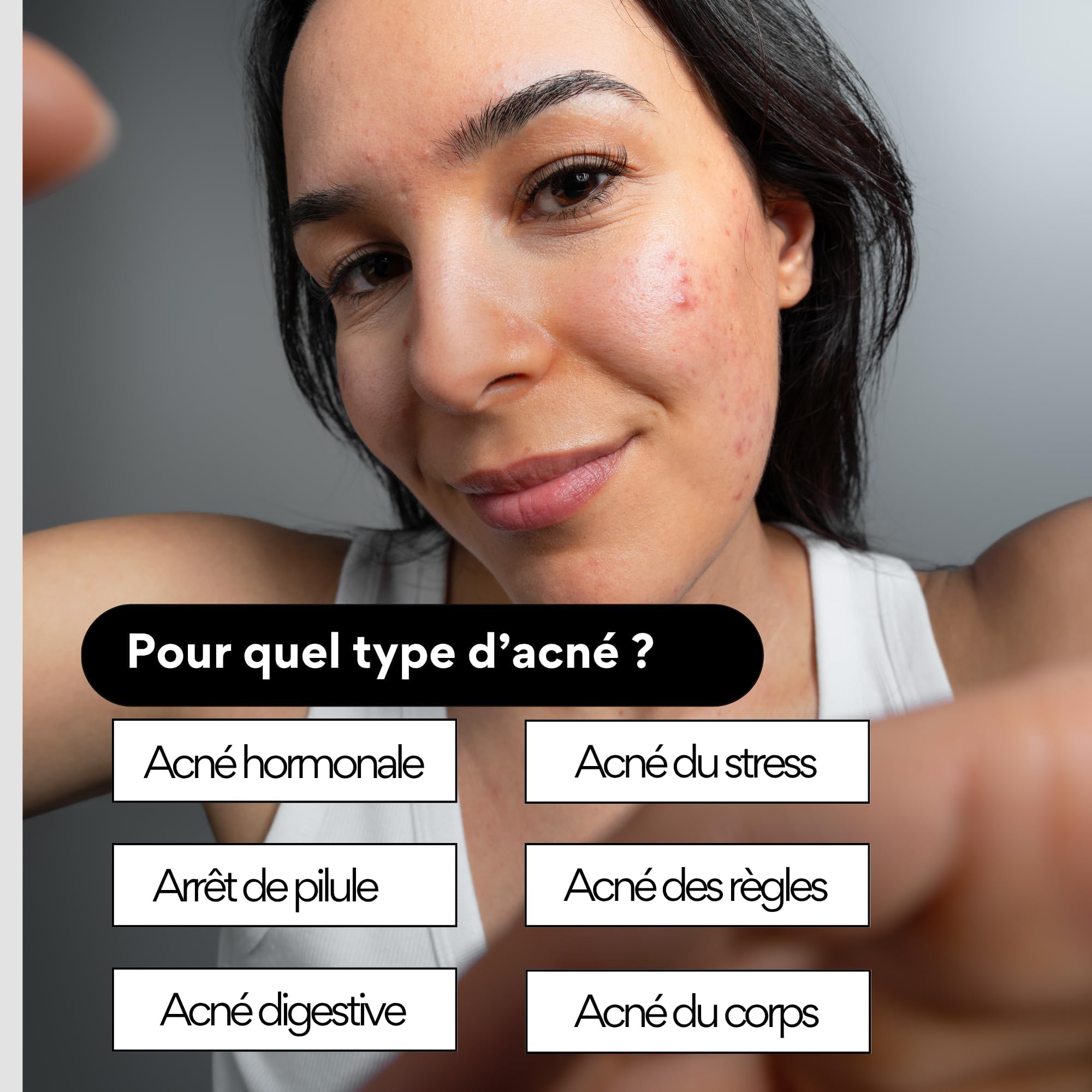 Skin & Out - Complément Alimentaire Stop-Boutons - Complément Alimentaire Nettoyant