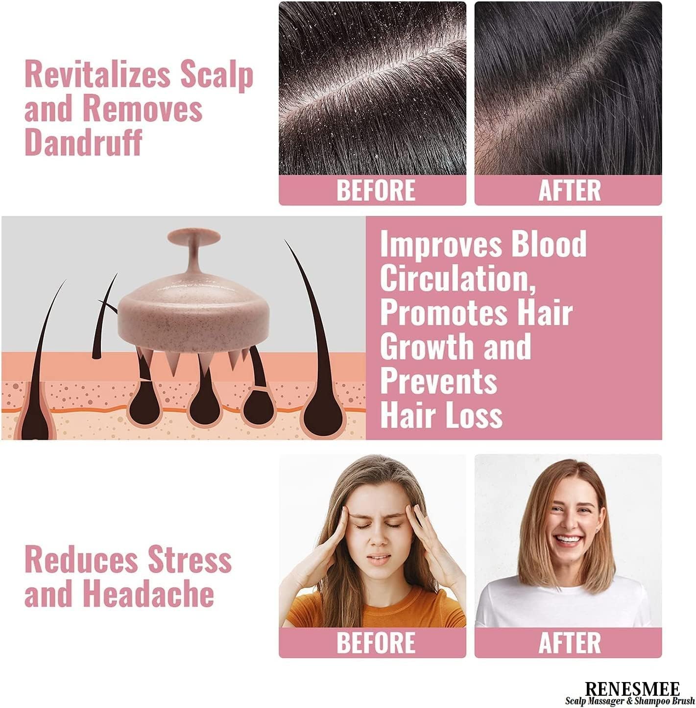 QIQI® Scalp Measer Shampoo Brush, Eco-Friendly Wheat straw body with soft silicon bristles, hair scrubber, exfoliator dandruff removal, prevents hair loss for men, women (JW35) QIQI® Scalp Measer Shampoo Brush, Eco-Friendly Wheat straw body with soft silicon bristles, hair scrubber, exfoliator dandruff removal, prevents hair loss for men, women (JW35)