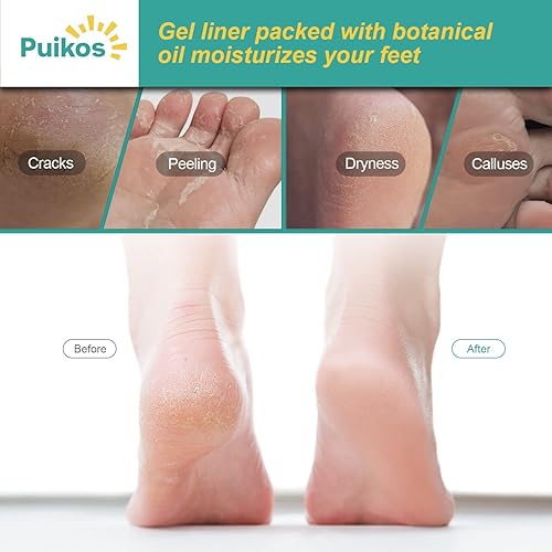 Miniatura 6 de Puikos Calcetines hidratantes para mujeres y hombres, calcetines de pies secos, calcetines de talón, reparación de talón agrietado, tratamiento de