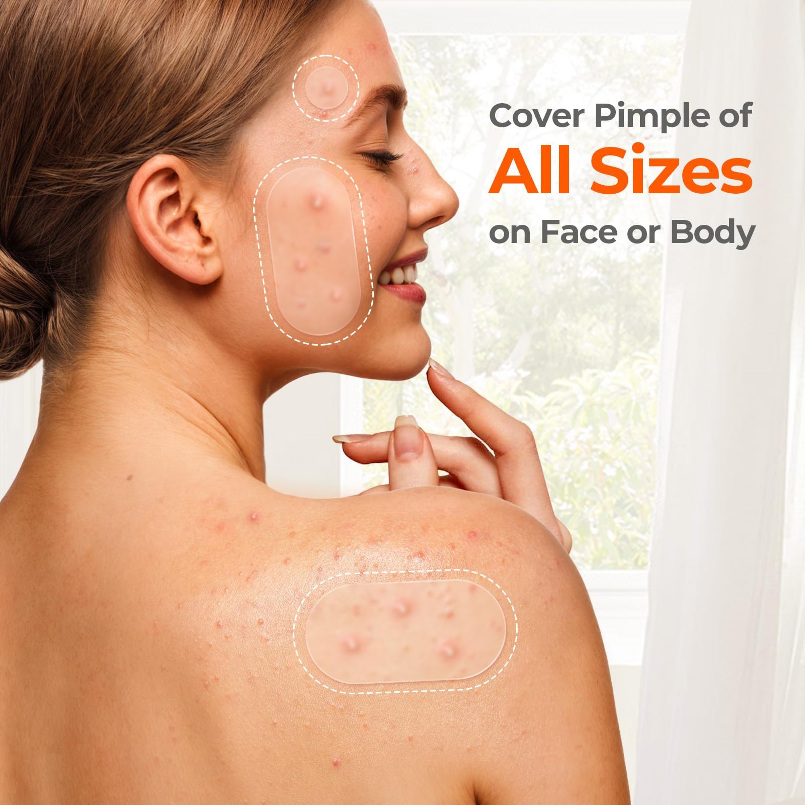 TKTK 443 Count Pimple Patches for Face, Hydrocolloid Acne Patch Bulk, Acne Stickers for Covering Cheeks, Forehead, Chin Blemishes Zit Breakouts for All Skin Types (Dots, Strip, Contoured 5 Sizes) — view 8