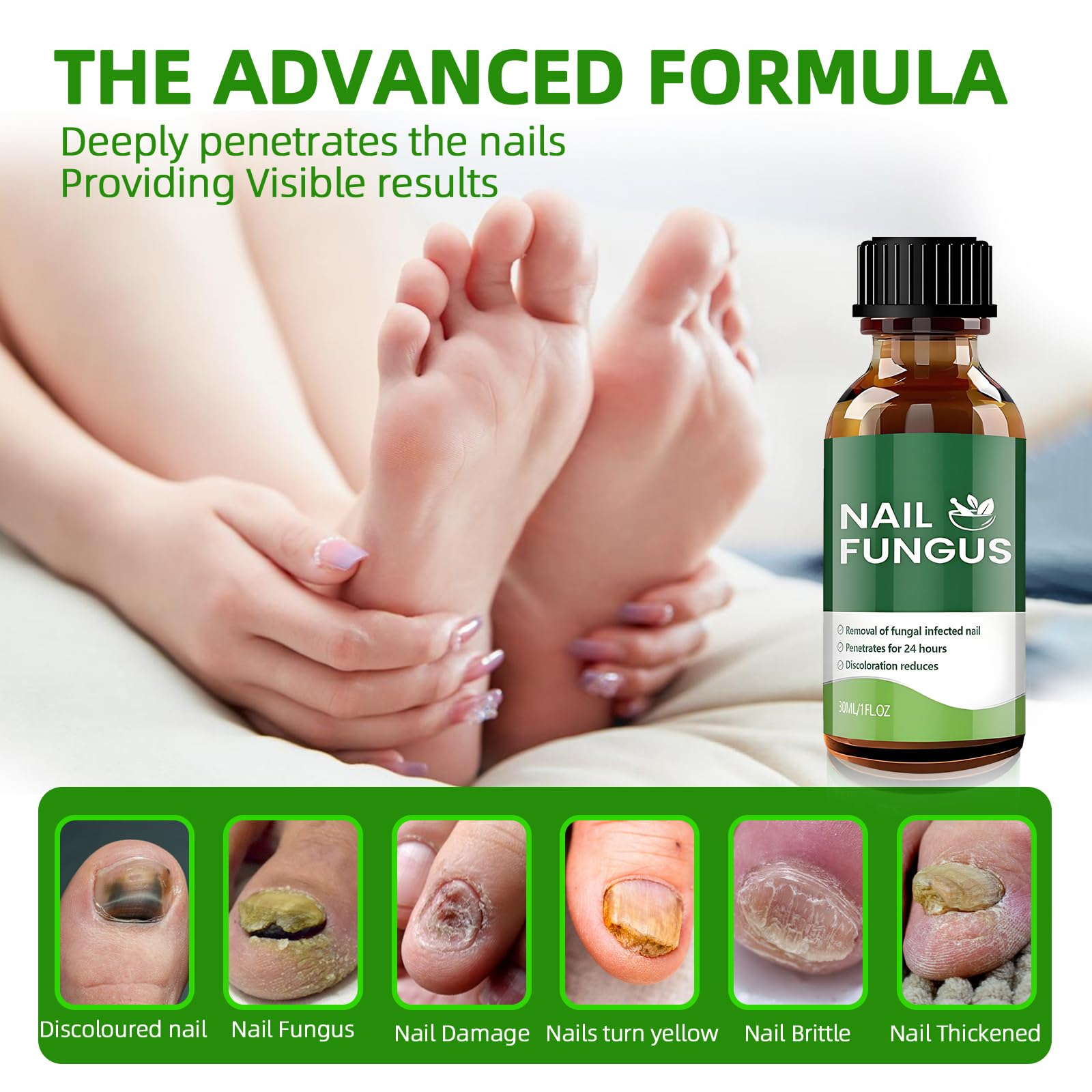 Toenail Fungus Treatment Extra Strength, Brush-On Nail Fungus Treatment with Botanical Oils for Thick, Yellow, Brittle, Discolored & Damaged Toenails 1 Fl Oz (Pack of 1) | — Amazon image 3