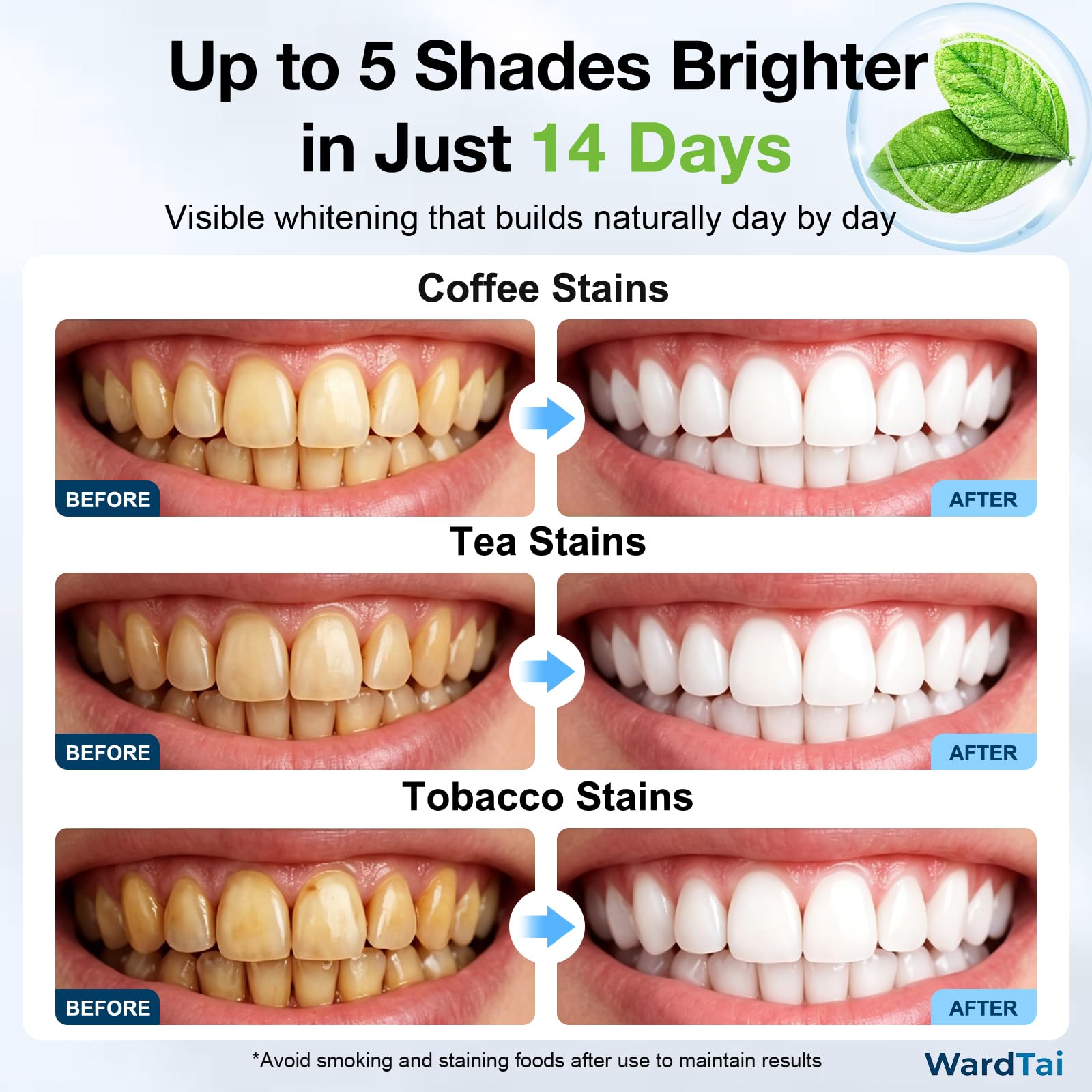 Sensitive Teeth Whitening Strips - 7-Day Starter -5