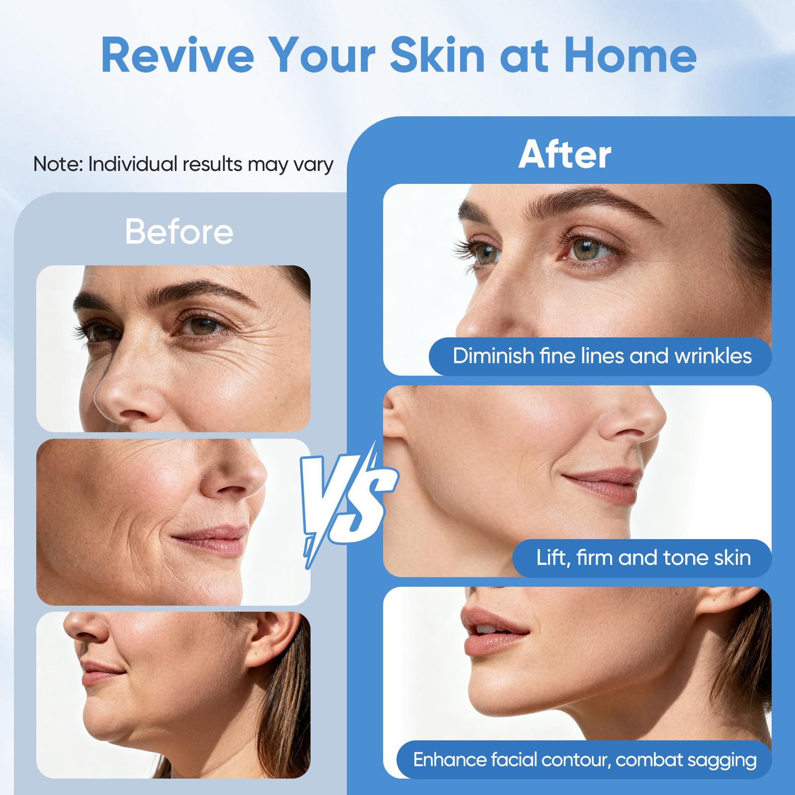 Dispositivo de cuidado de la piel RF 6 en 1, máquina de belleza facial LED 5 niveles de intensidad, Dispositivo de belleza de radiofrecuencia para rostro, vientre, cuello, piernas y brazos