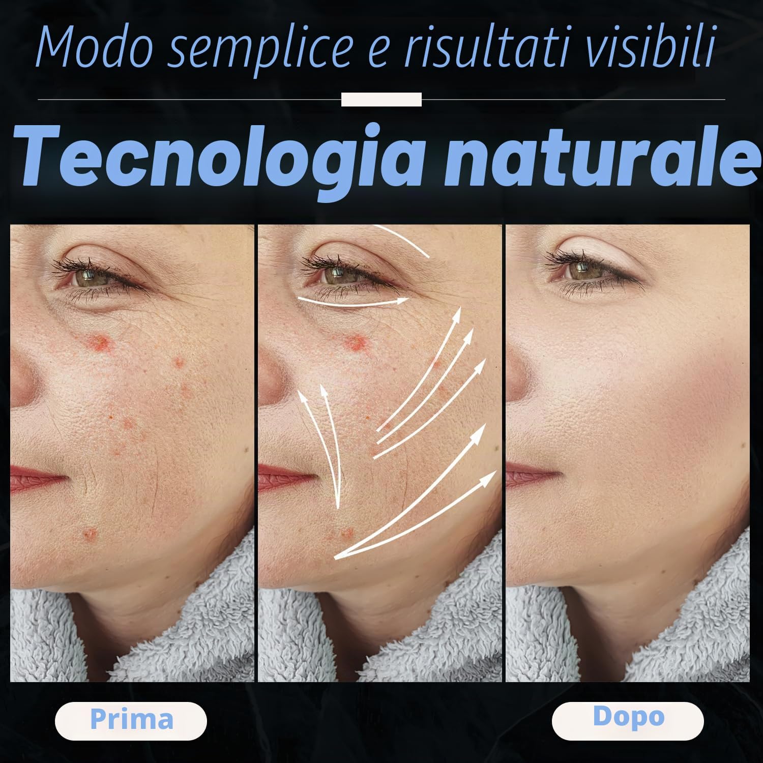 UUPAS Bacchetta Blu ad Alta frequenza Viso Professionale - Macchina Facciale ad Alta Frequenza con 4 Tubi