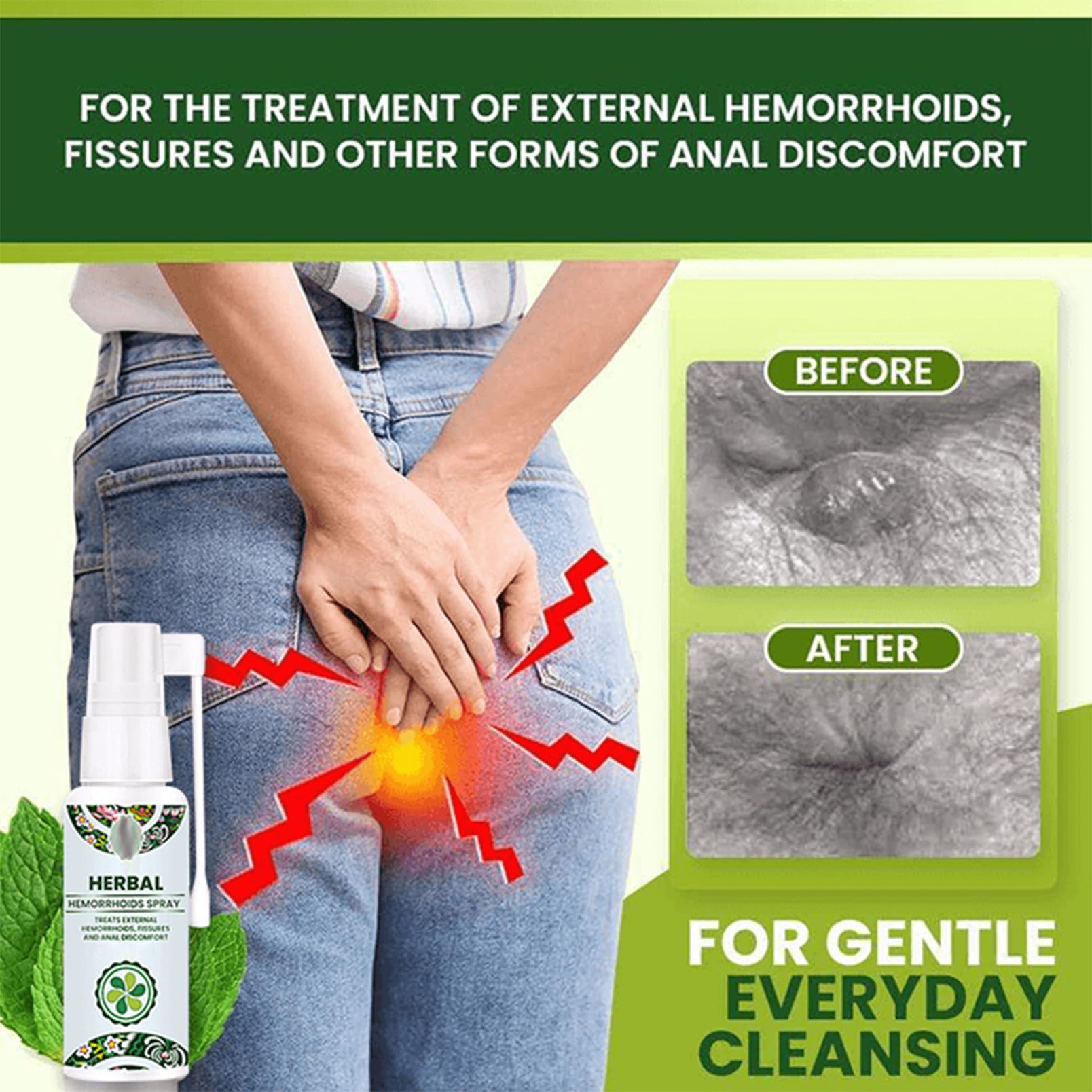 Herbal Hemoroidy spray na hemoroidy w sprayu, ochrona hemoroidów, łagodzi swędzenie, pieczenie i dolegliwości, naturalny, wegański i nietestowany na zwierzętach