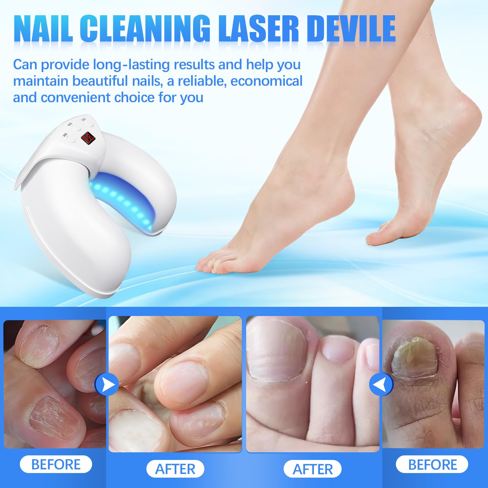 Nail Fungus Treatment for Toenail (B) - Image 4