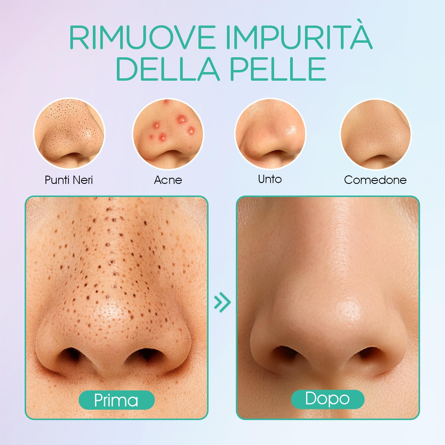 VOYOR Aspiratore Punti Neri 6-In-1 Aspira Rimozione di Elettrico Comedone Estrattore Pulizia Viso Tramite Ricaricabile per Uomini e Donne BR410