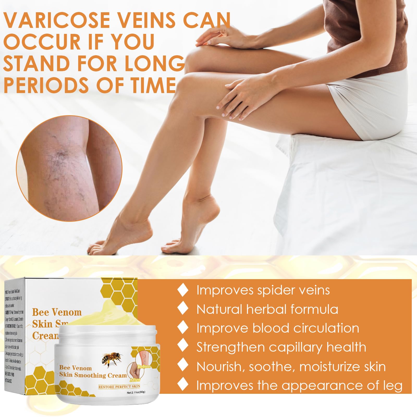 Crème pour Contre les Varices au Venin d'Abeille, Crème de Traitement des Varices au Venin d'abeille, Pommade de Récupération au Venin d'abeille pour les Jambes, Convient à Tous Les Types De Peau, 60g
