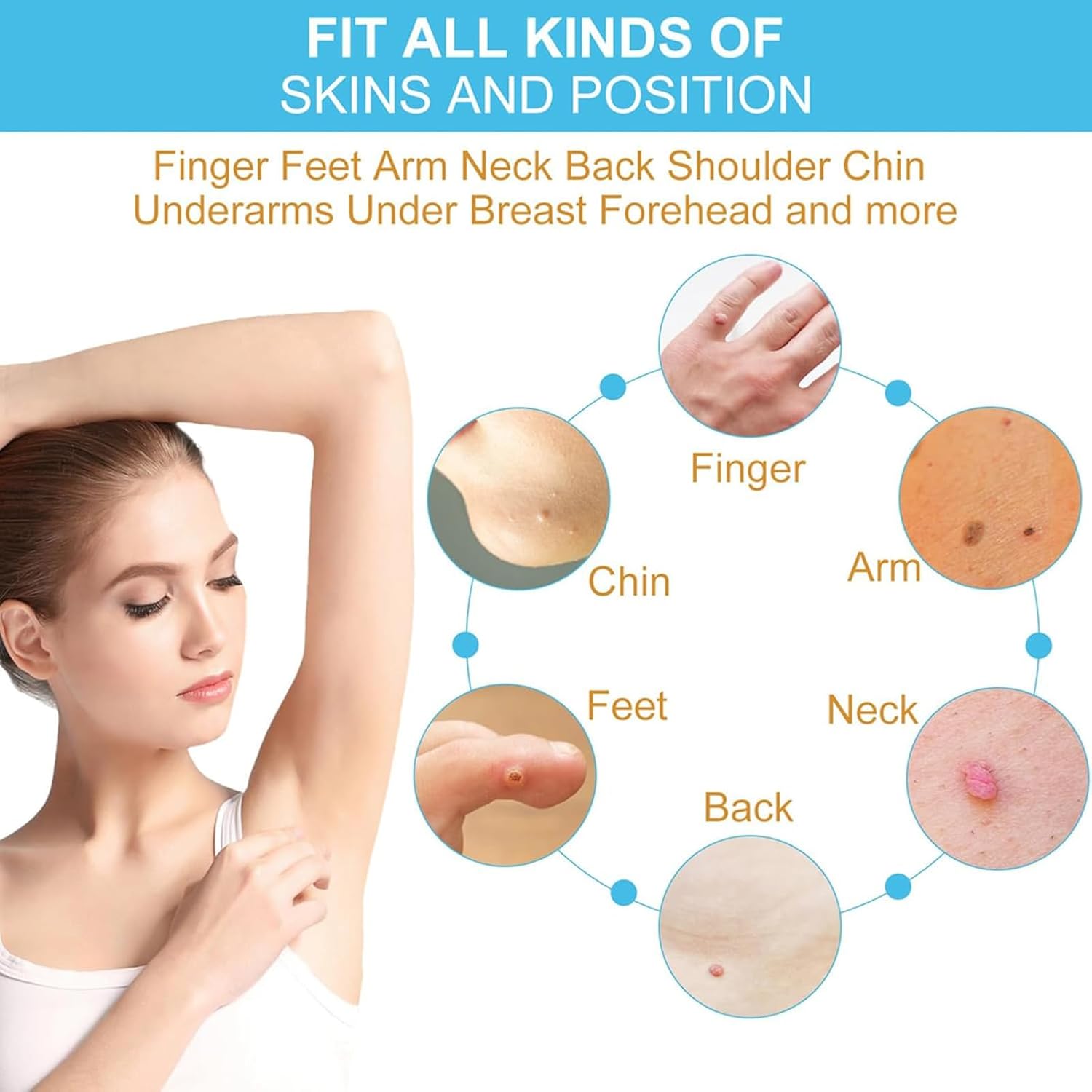 Diagram showing various body parts where skin tags and warts can be treated, including finger, arm, neck, back, feet, and chin.