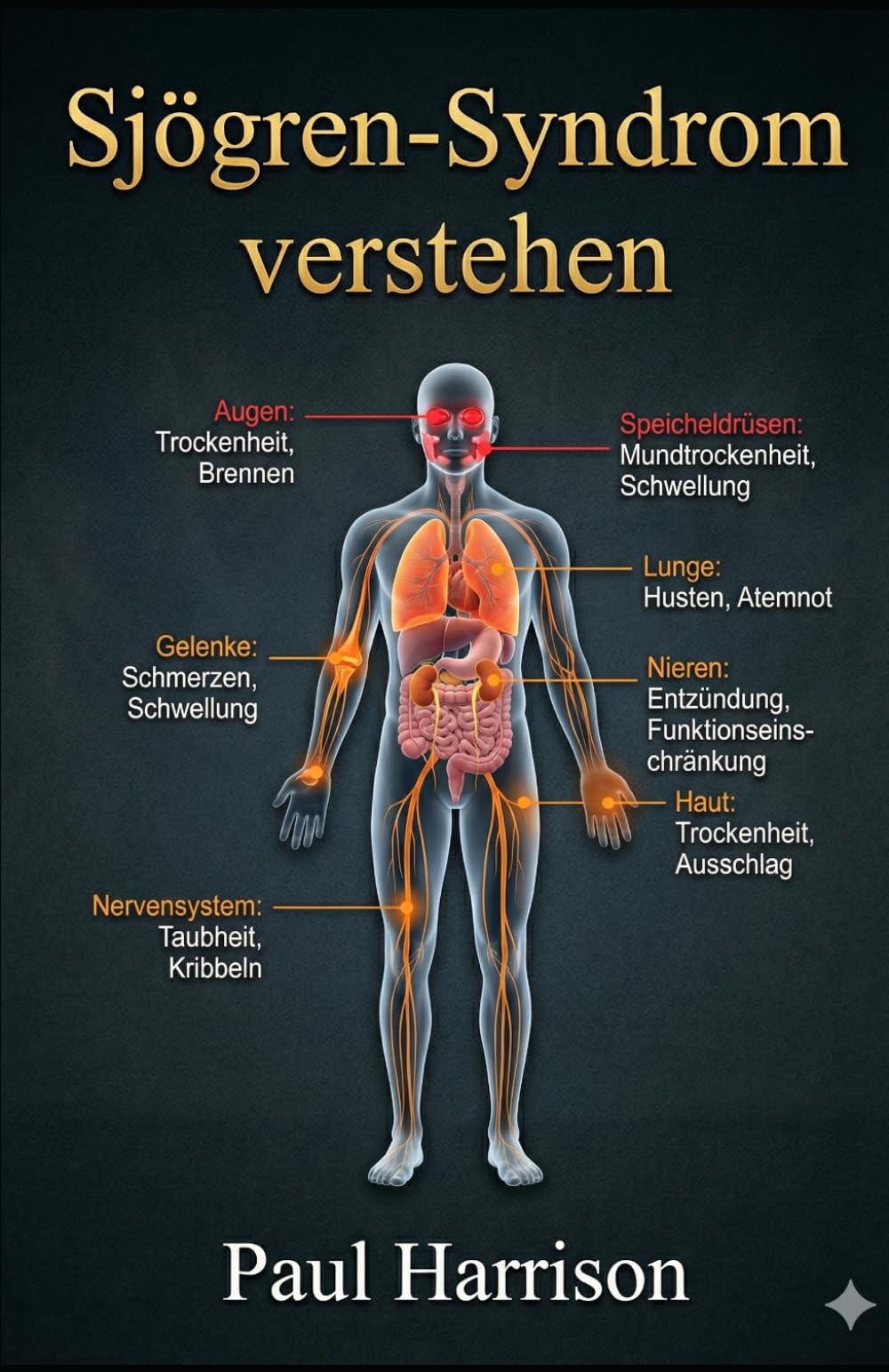 Sjögren-Syndrom verstehen (Seltene Krankheiten verstehen)