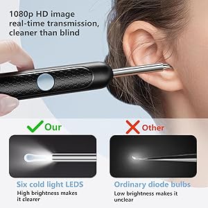 Ear Wax Removal Kit - Ear Cleaner with Camera with 1080P, Ear Wax Removal Tool with 6 LED Light, 6 Ear Pick, 10 Ear Cleaning Kits, Ear Camera Wax Rremoval for iOS & Android