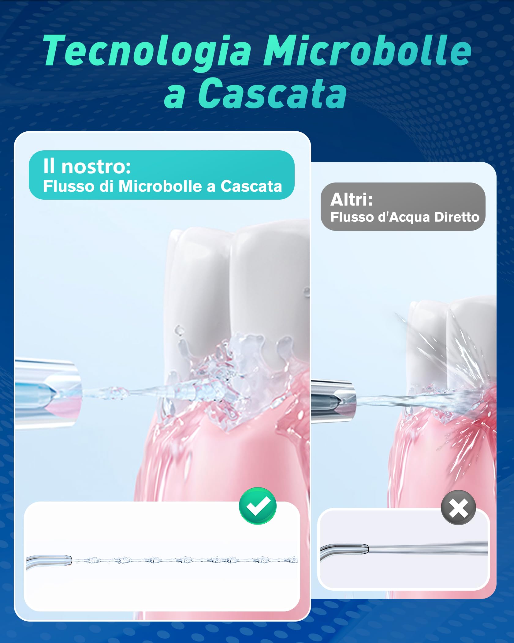Glracd Vincitore del test per l'irrigatore orale 2025, 4 modalità, innaffiatore d'acqua professionale, senza fili, serbatoio da 300 ml, detergente interdentale con 6 punte a getto di pressione
