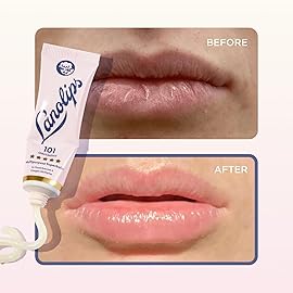 Lanolips 101 Ointment Multi-Balm Duo, Original Superbalm - Contains Pure Lanolin Oil for Smooth, Hydrated, & Healthy Lips - Natural Lip Balm for Dry Lips, Cuticles, & More (2-Pack, 0.52 oz each)