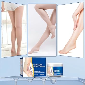 2Pcs Varicose Veins Treatment Cream for Legs Natural Ingredients, Suitable for Most Skin Types