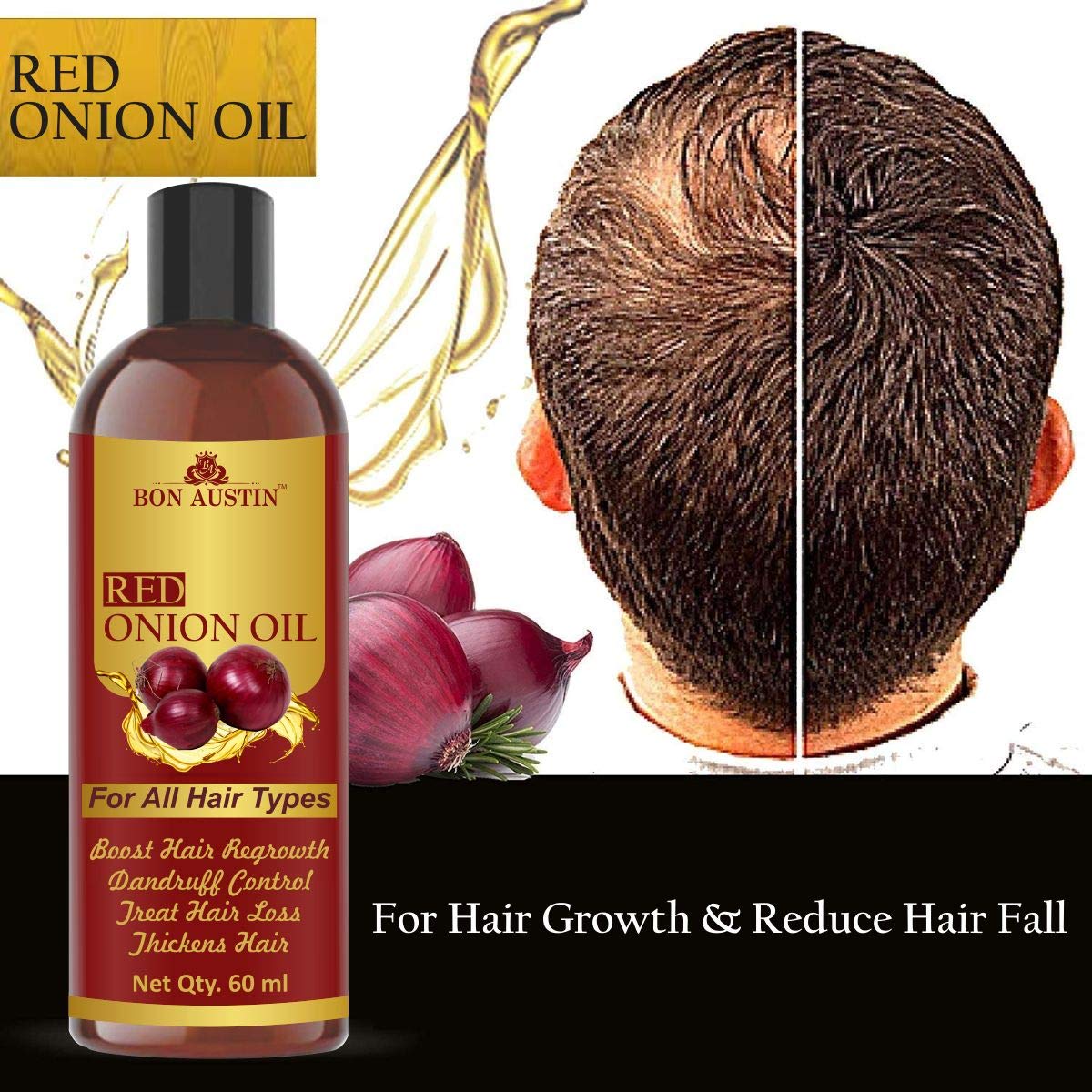Bon Austin Red Onion oil Combo pack of 2 bottles of 60 ml(120 ml) 2