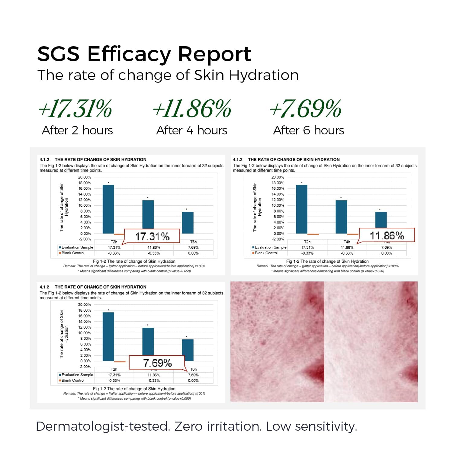 WNP 3 % Hyaluronsäure-Serum für das Gesicht mit 4D-Mehrschicht-Hydratation, ultra-feuchtigkeitsspendendes Anti-Aging-Serum, feuchtigkeitsspendend für trockene, empfindliche Haut