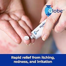 Globe (4 Pack) Hydrocortisone Maximum Strength Anti-Itch Cream 1% w/Aloe, Intensive Formula for Redness, Rash, Bug & Mosquito Bites, Eczema, Hemorrhoids, Sensitive Skin, Instant Itch Relief,1 oz Tube