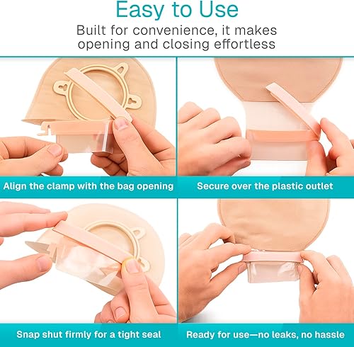 Miniatura 8 de Vive 10 clips para bolsas de ostomía  Abrazaderas universales de sellado de bolsas drenables  Suministros de ostomía de grado médico para