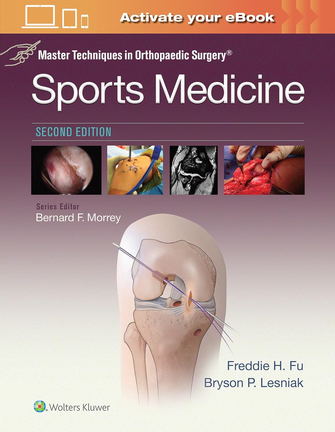 Master Techniques in Orthopaedic Surgery: Sports Medicine      Second Edition