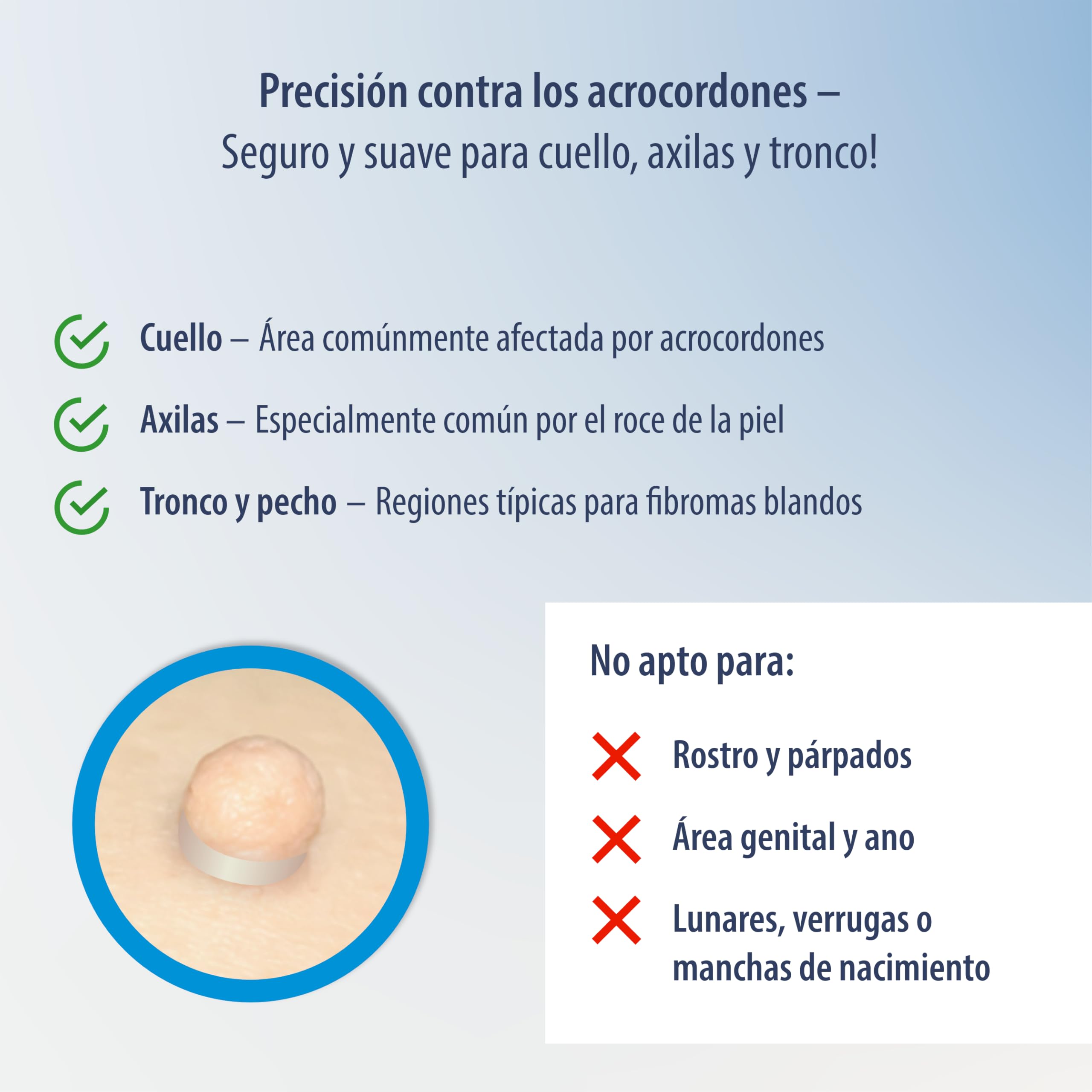 Evolsin® Anti acrocordones – eficaz contra las verrugas del tallo para el hogar – eficaz, seguro y fácil sin productos químicos – Ideal para cuello, axilas y cuerpo
