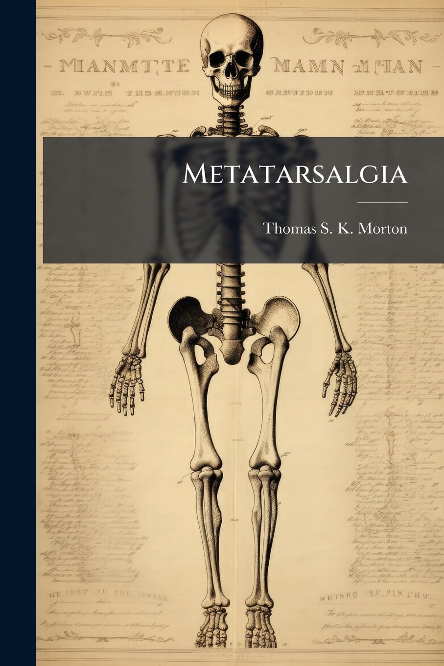 Metatarsalgia