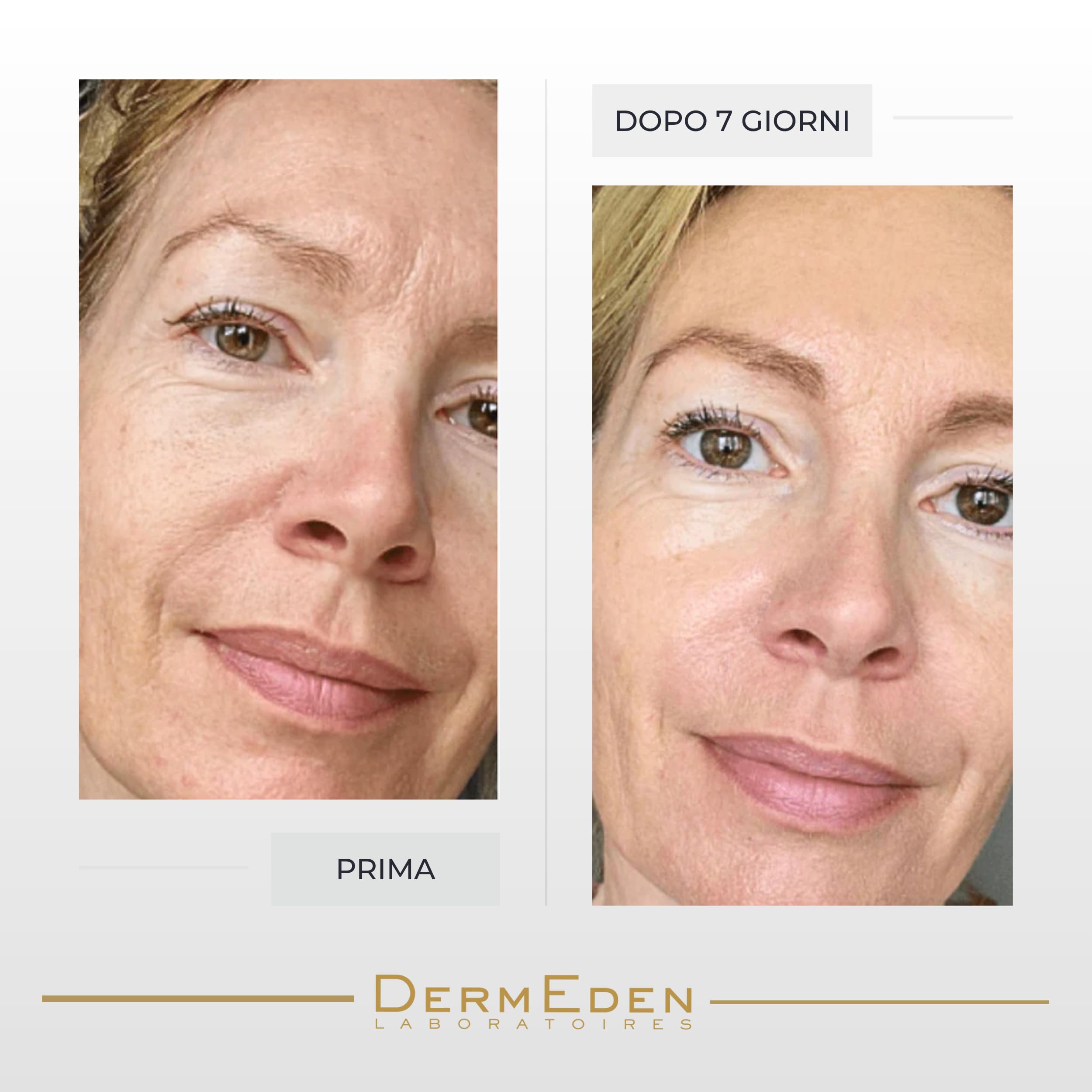 DermEden - Crema da giorno 50 ml per pelli da miste a grasse SPF 50-4 azioni in 1 - Protezione completa contro gli effetti nocivi della luce - Anti-macchie e anti-infiammatorio - Prodotto in Francia