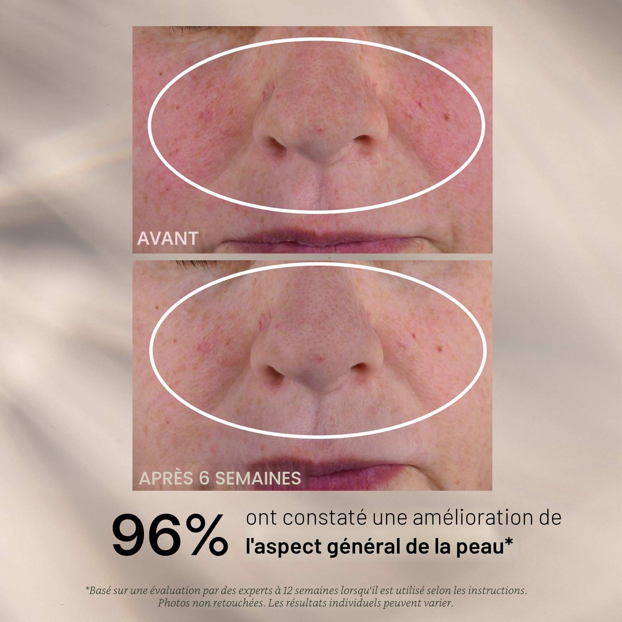 Sérum Multi-Correcteur de Nuit au Rétinol 30ml