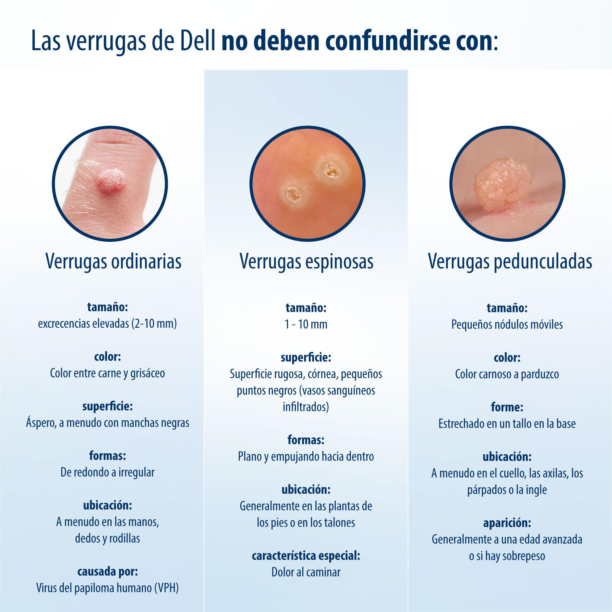 Evolsin® Remedio para el molusco contagioso I Para adultos y niños a partir de 2 años I Tratamiento suave y eficaz del molusco contagioso