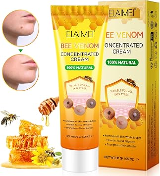 Skin Tag Removal Cream,30g Wart Remover Cream,Safe Mole Remover for Skin Care,Effective Wart Remover,Gentle Corn Remover for Feet Hands Face, Verruca Plasters for Corns Calluses