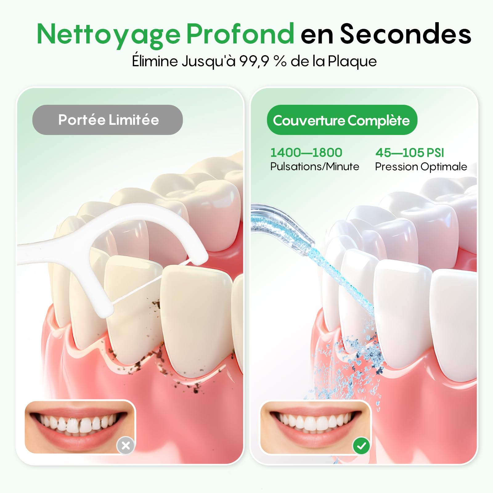 FRESKO Hydropulseur Dentaire, 300ML Irrigateur Buccal avec 4 Modes 45-105PSI, Batterie 2600mAh, Etanche IPX7, 5 Buses pour Appareils Dentaires Et Implants, Nettoyeur Dentaire Portable