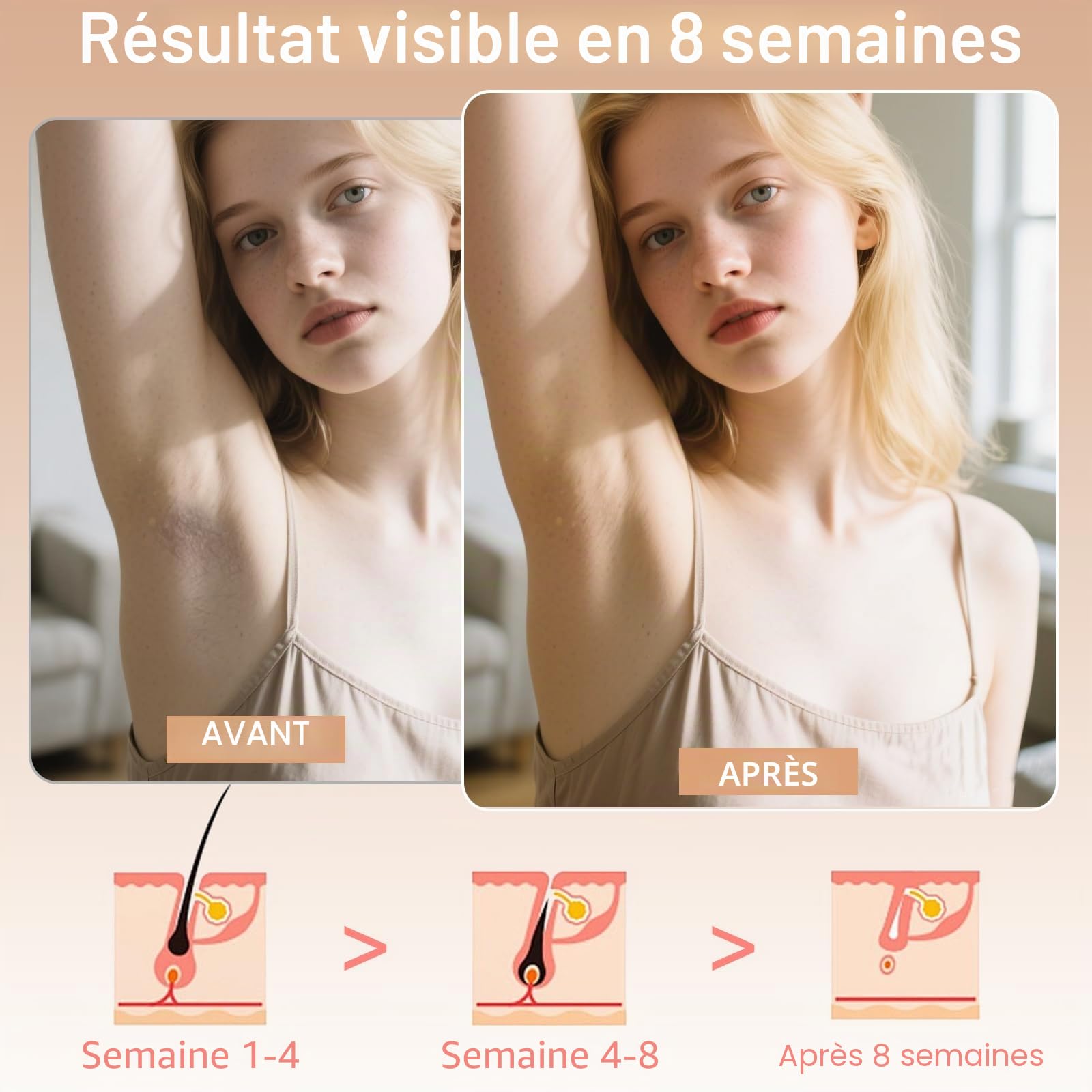 NICEWIN Épilation IPL avec fonction congélation - Appareil IPL sans douleur avec 3 modes (HR/SC/RA), 9 niveaux d'énergie, 999 999 impulsions lumineuses pour homme et femme - Idéal pour le visage, le