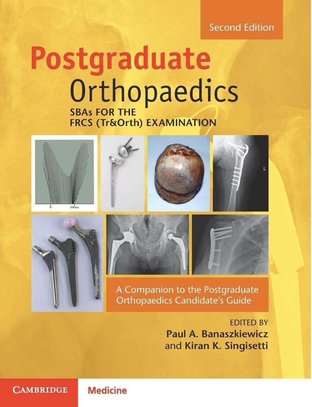 SBAs for the FRCS (Tr&Orth) Examination: A Companion to the Postgraduate Orthopaedics Candidate's Guide