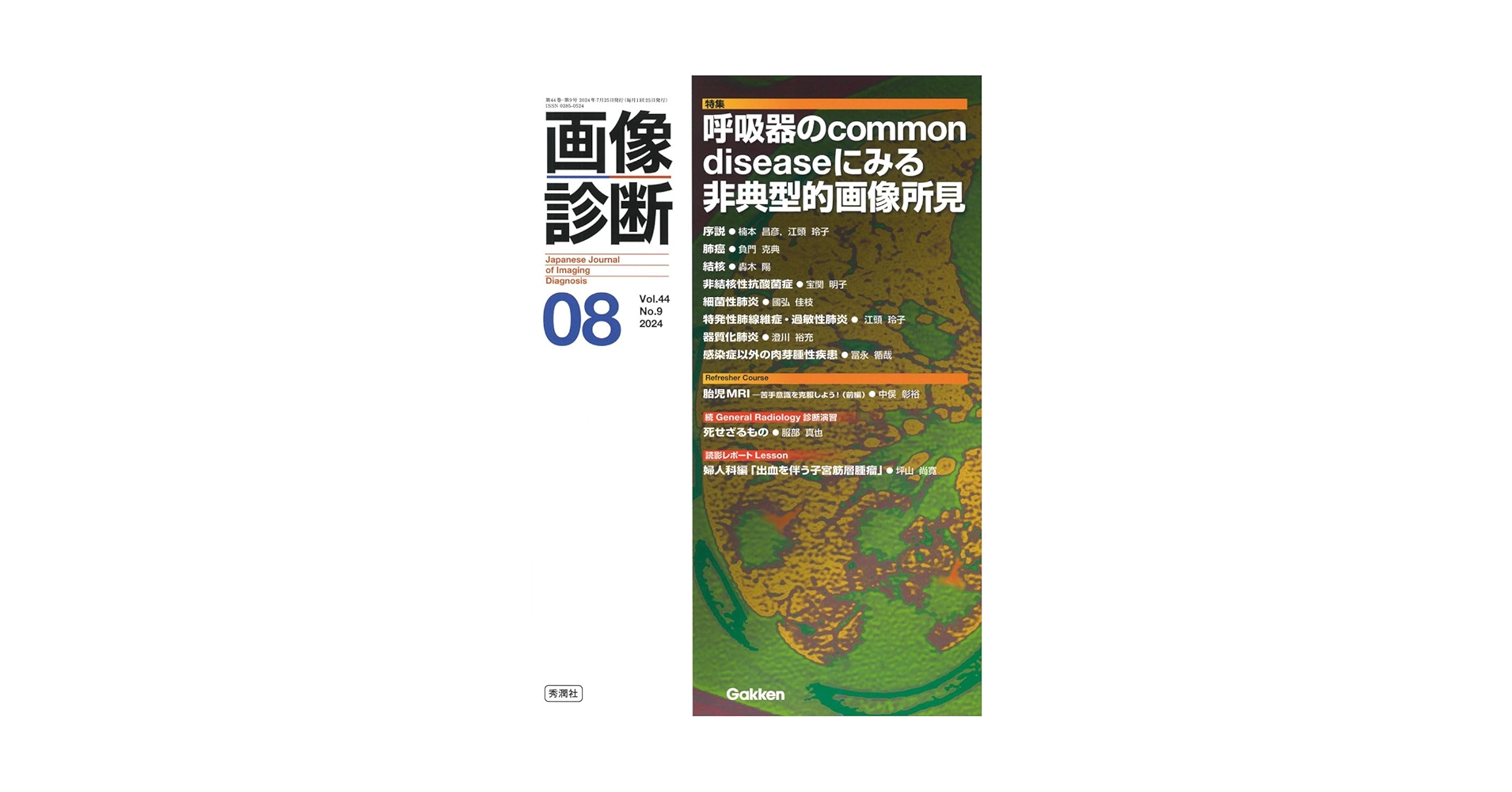 画像診断2024年8月号 Vol.44 No.9: 呼吸器のcommon diseaseに