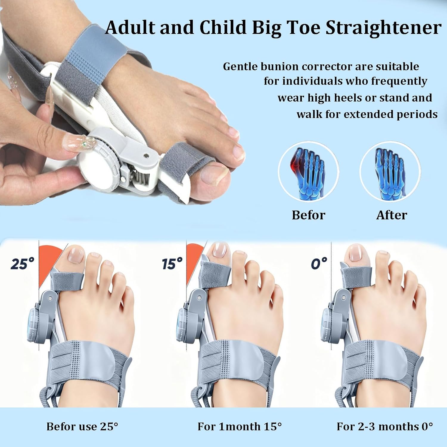 Bunion Corrector for Women & Men, Comfortable Big Toe Straightener with Silicone Pad | Adjustable Knob - Snug Fit for Left/Right Big Toes, Wear While Sleeping (1 Pack)