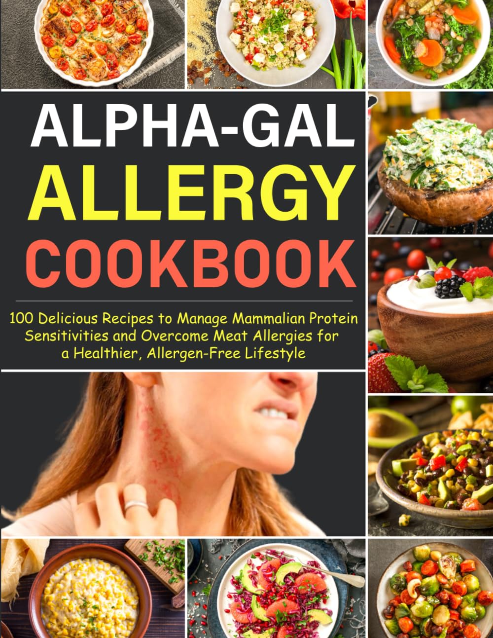 Alpha-Gal Allergy Cookbook: 100 Delicious Recipes to Manage Mammalian Protein Sensitivities and Overcome Meat Allergies for a Healthier, Allergen-Free Lifestyle