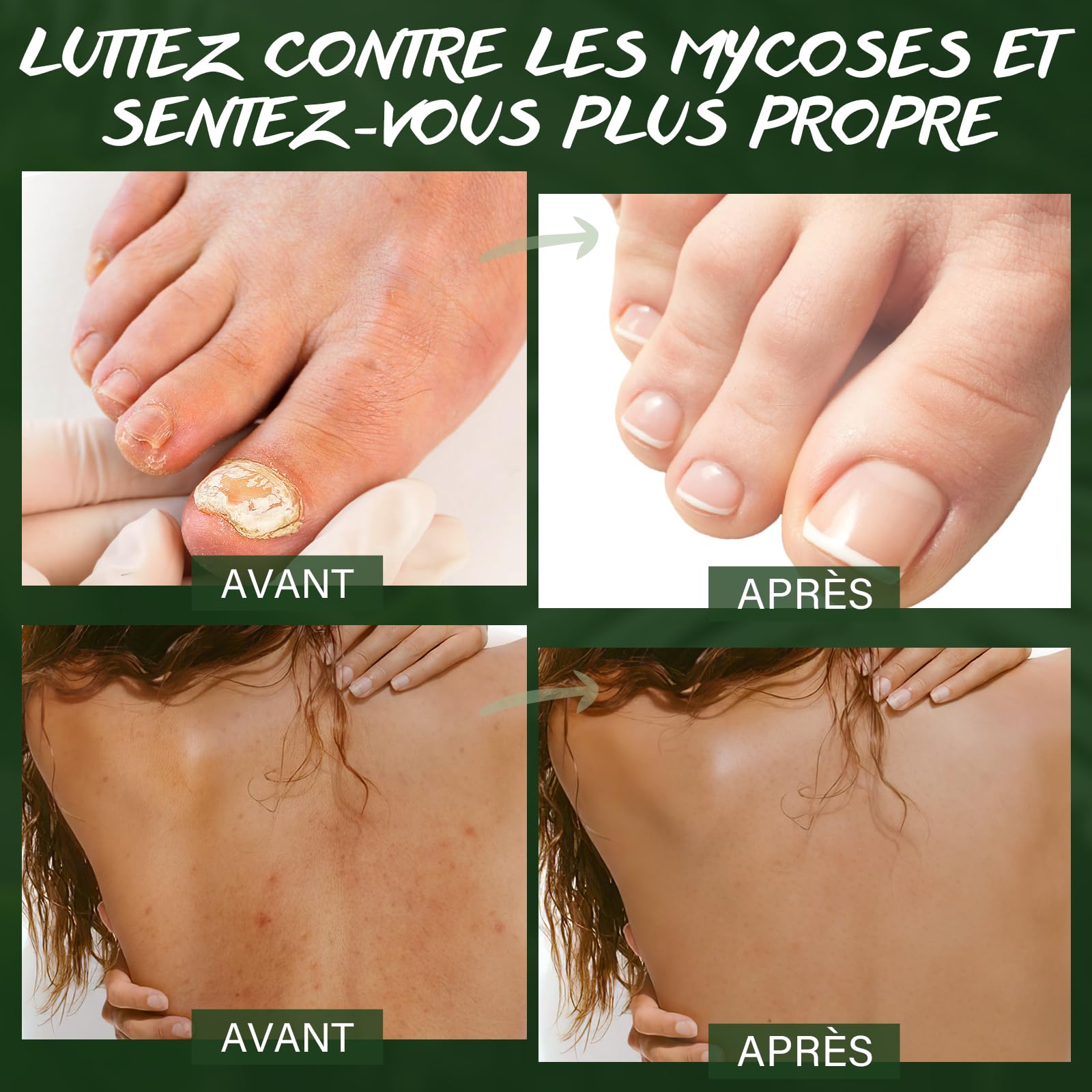Gommage Corporel à L'huile D'arbre à Thé, Améliore les Mycoses Cutanées, les Démangeaisons, L'eczéma Marginé, les Odeurs Corporelles. Gommage au Sel Marin pour Exfolier et Hydrater la peau, 360g