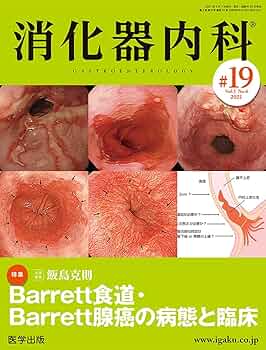 38♥♥♥♥食道腫瘍の臨床病理♥♥♥♥ 38♥♥♥♥食道腫瘍の臨床病理♥♥♥♥
