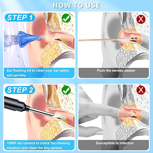 Miniatura 2 de Kit de herramientas de eliminación de cera de oído 2 en 1, kit de limpieza de oídos, kit de limpieza de oídos para adultos, perro, gato, kit de
