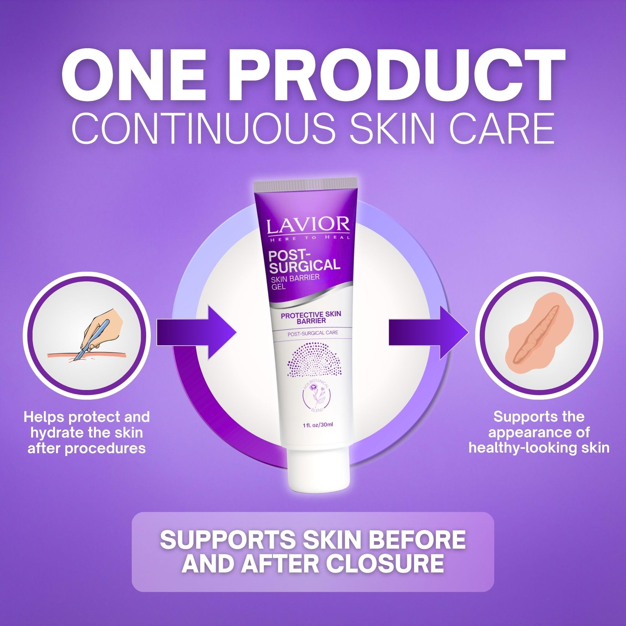 LAVIOR Botanical Gel post-quirúrgico (28,3 g) – Cuidado de recuperación de incisiones – Cuidado suave a base de plantas – Sin silicona