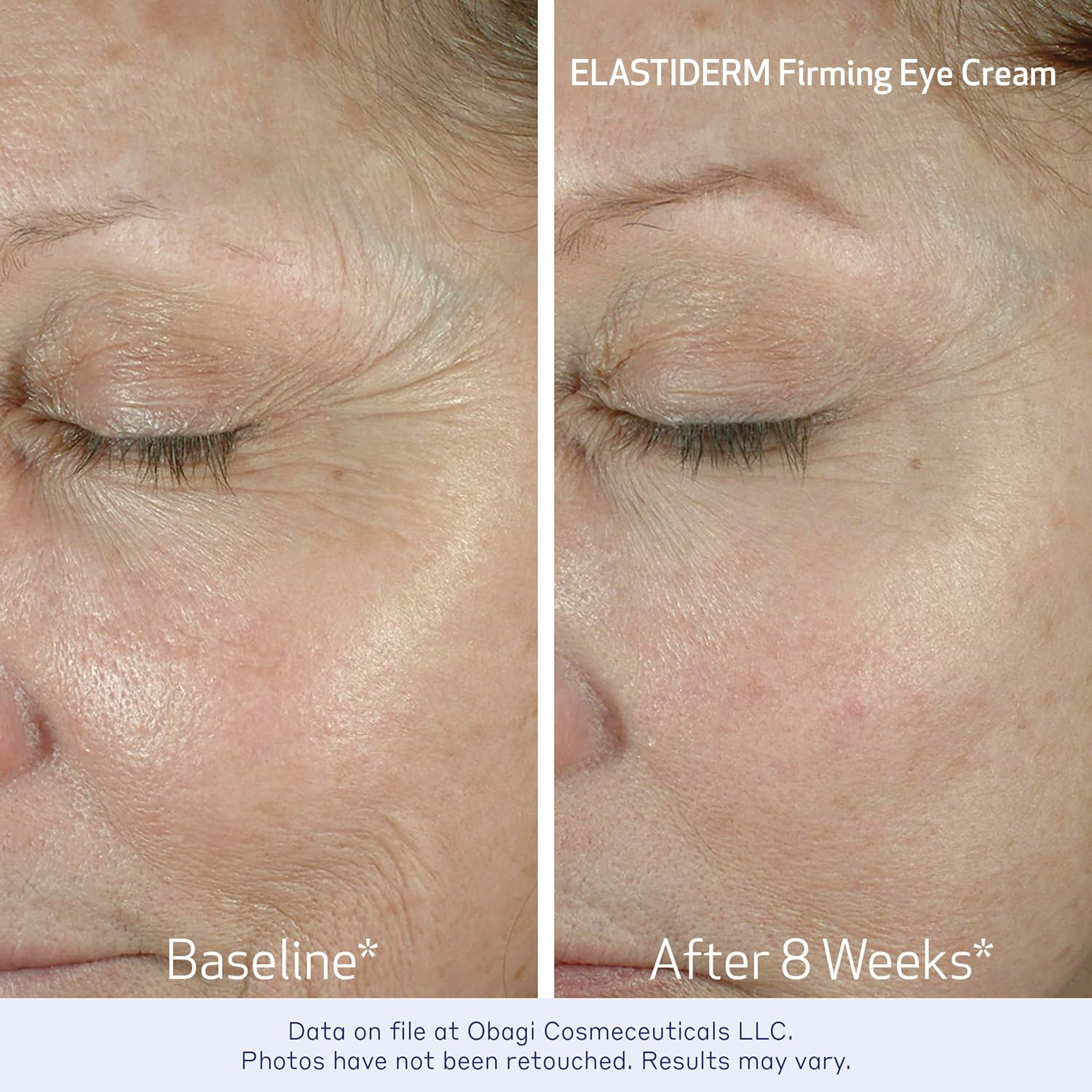 Obagi ELASTIDERM Lift Up & Sculpt Facial Moisturizer and Eye Cream Set – Clinically Proven Anti-Aging Face Cream 1.7oz & Lightweight Eye Cream .5oz Help Reduce the Appearance of Fine Lines & Wrinkles