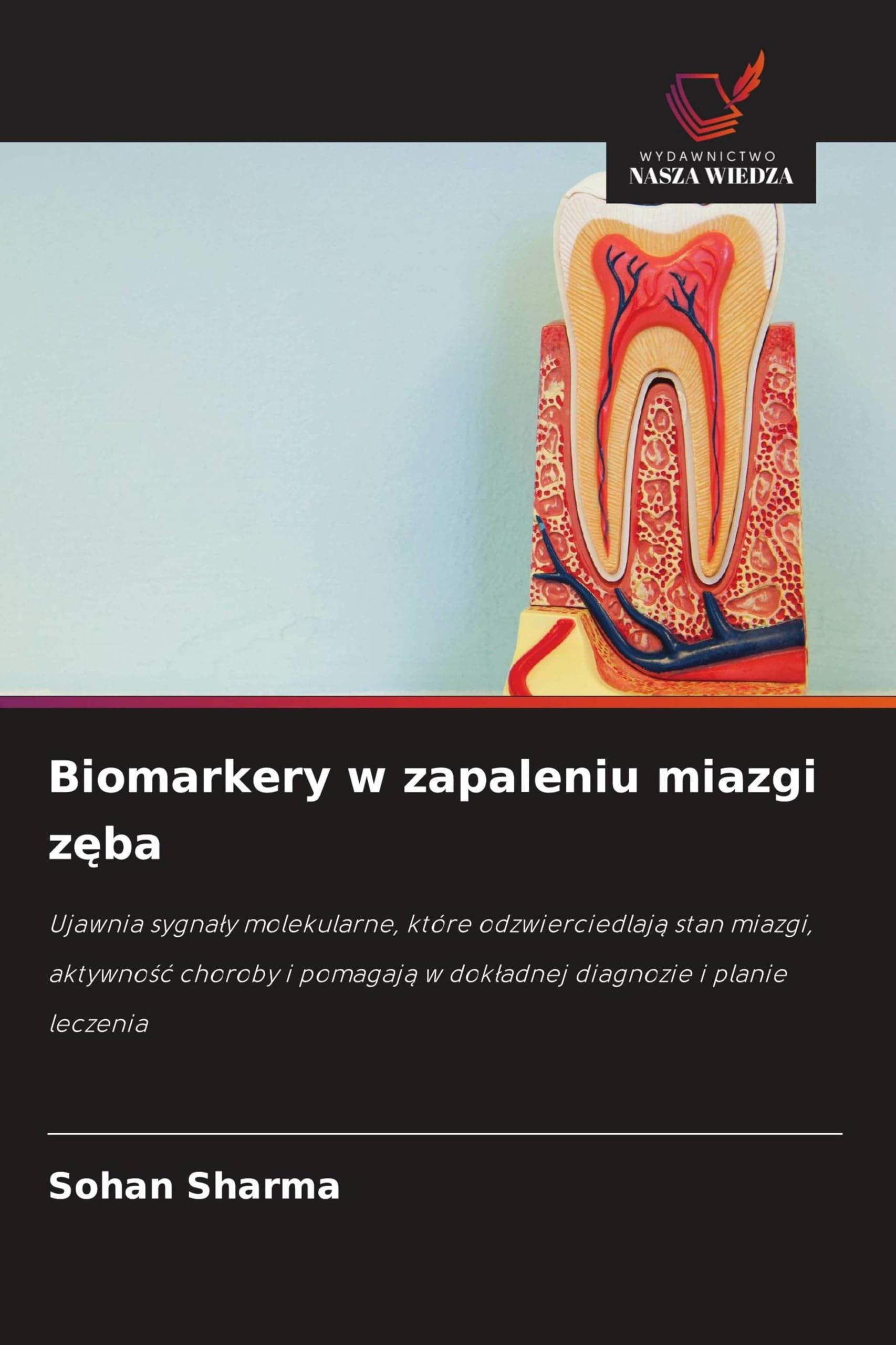 Biomarkery w zapaleniu miazgi zęba: Ujawnia sygna¿y molekularne, które odzwierciedlaj¿ stan miazgi, aktywno¿¿ choroby i pomagaj¿ w dok¿adnej diagnozie i planie leczenia