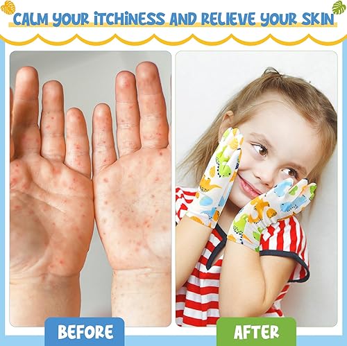 Miniatura 5 de 20 pares de guantes de eccema para niños, guantes de algodón hidratantes para piel irritada sensible, eccema, guantes elásticos reutilizables,