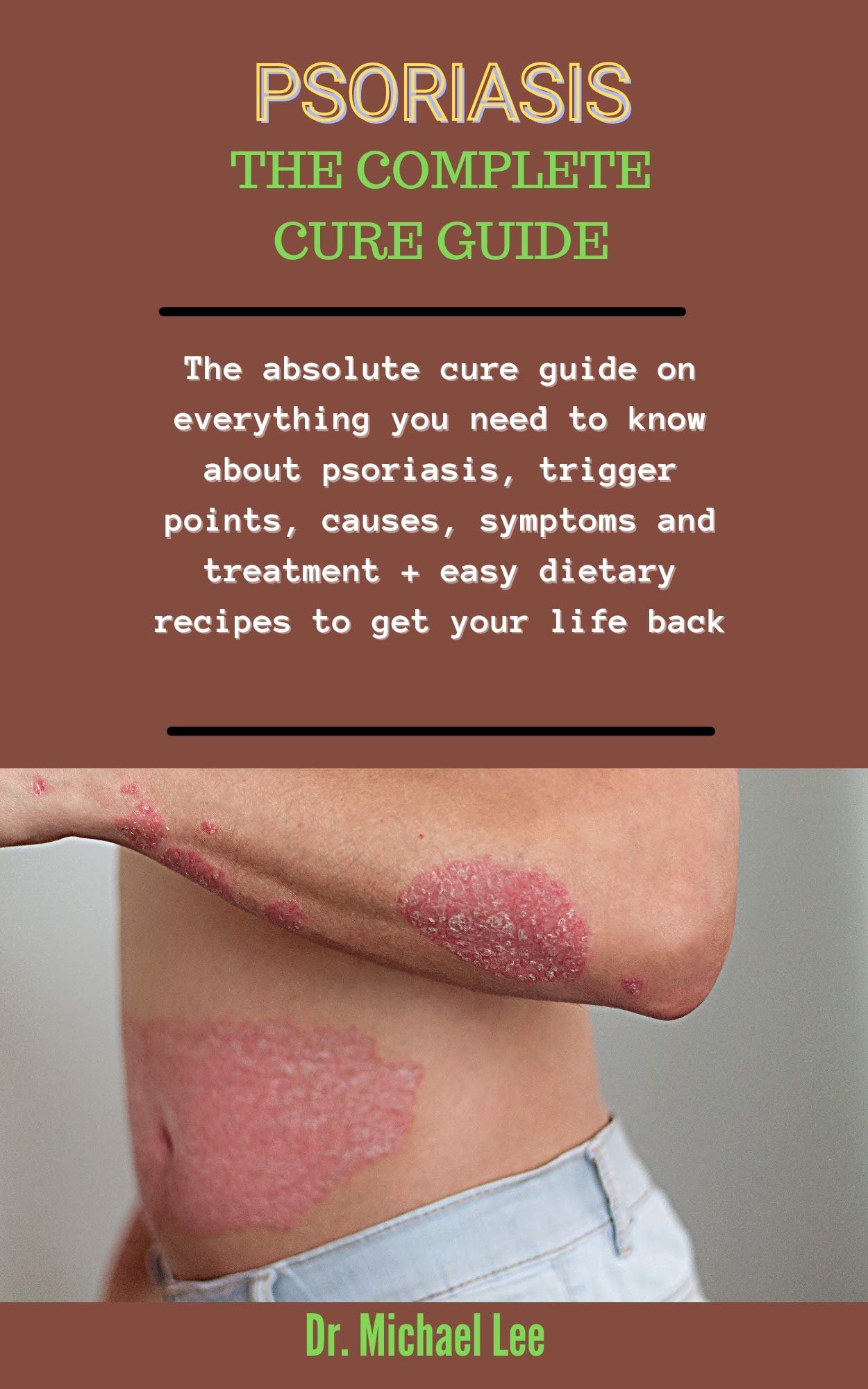 Buy Psoriasis The Complete Cure Guide The Absolute Cure Guide On