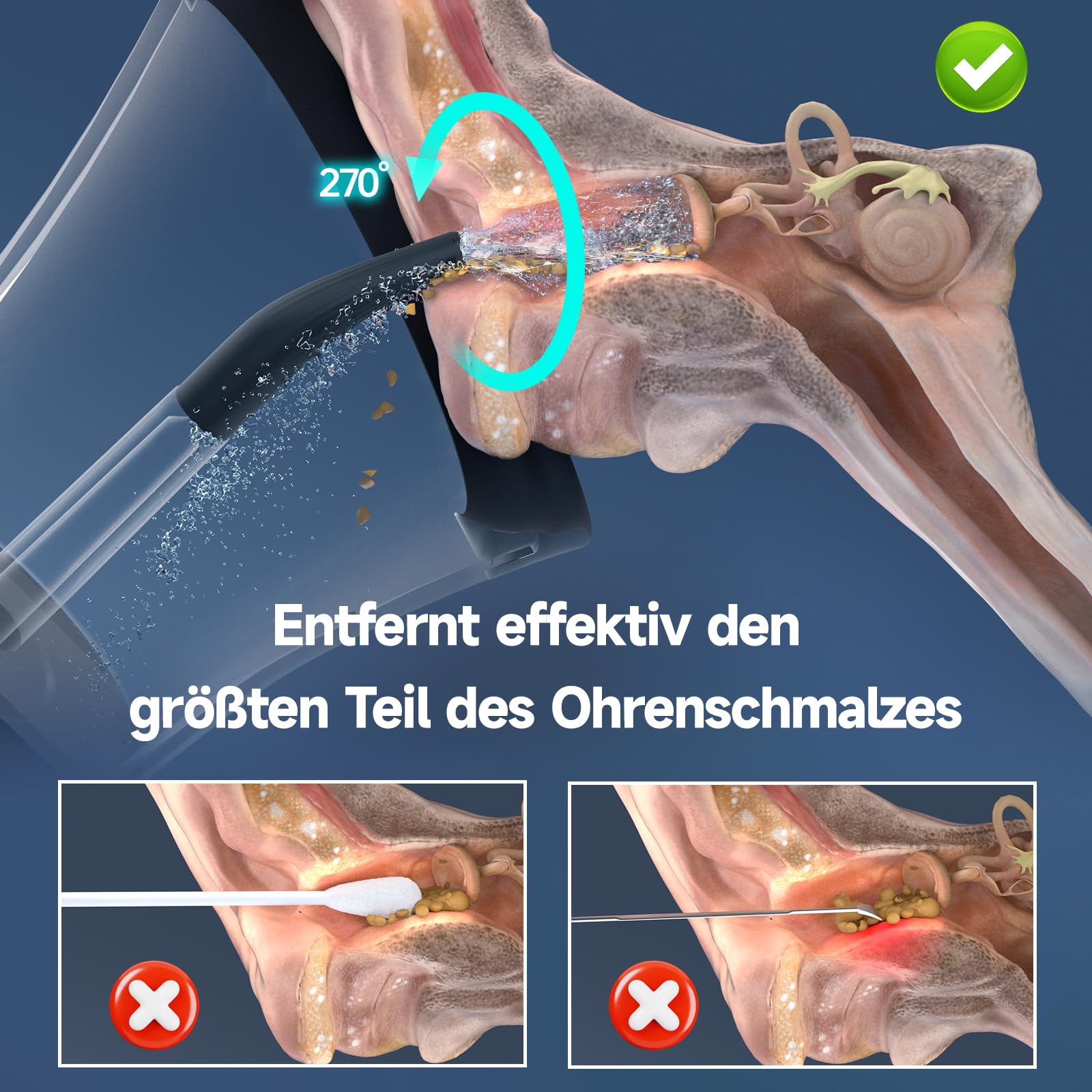 Morfone Nettoyeur Oreille, Utilisation d'une Seule Main, 4 Modes, Avertissements de Sécurité, IPX6 étanche, 5 Buses. Nettoyeur Oreille Adulte, Cure-cérumen pour Enfants (Noir)